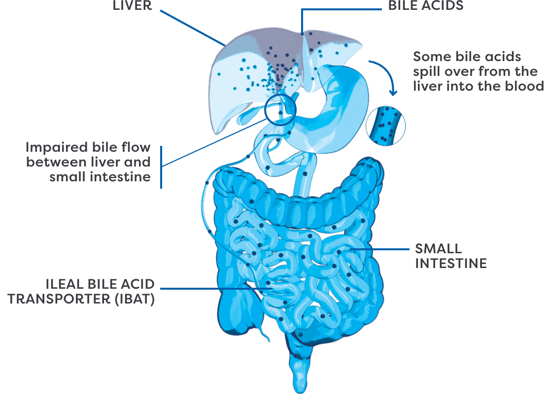 Mechanism of Disease Infographic