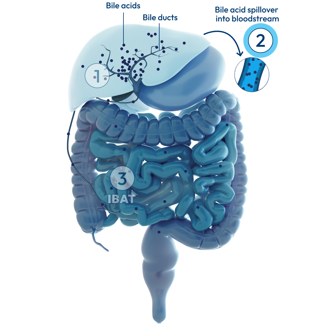 Liver and intestines, with a number 2 representing bile acid spillover.