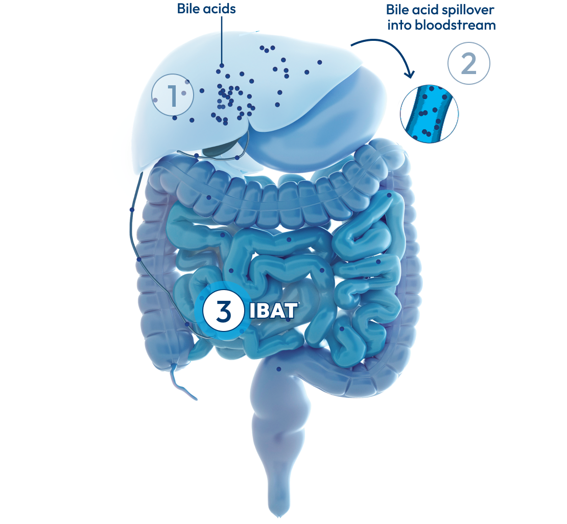 Graphic of the liver and intestines, with a number 3 representing IBAT.