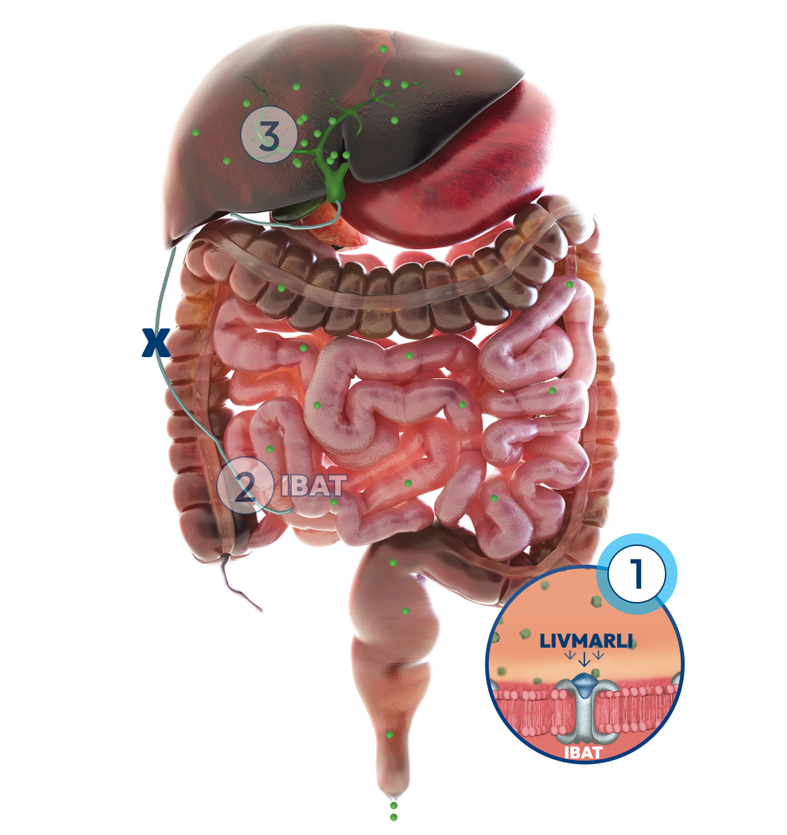 Graphic of the liver and intestines with a number 1 label representing how LIVMARLI targets and temporarily blocks IBAT.