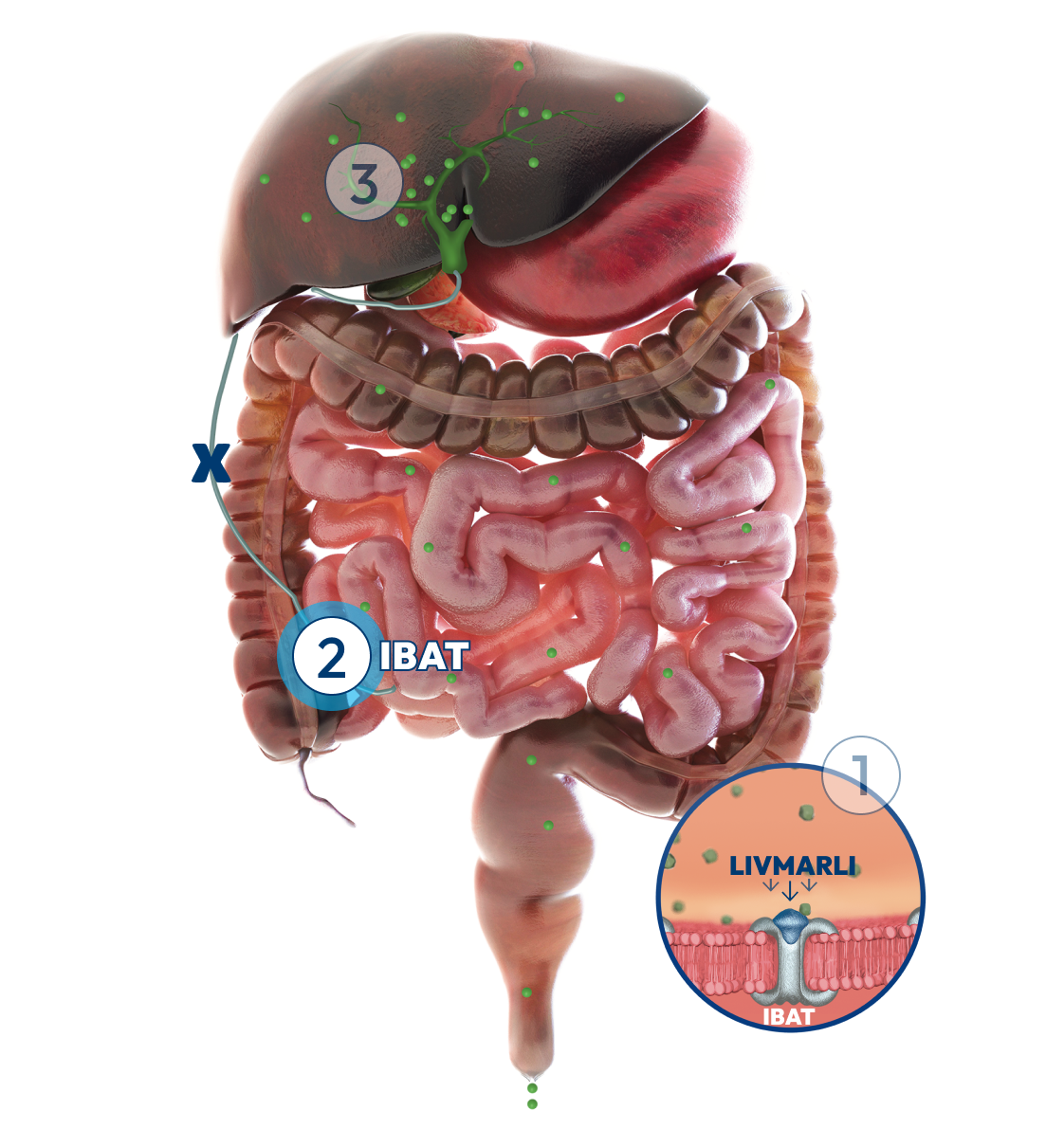 Graphic of the liver and intestines, with a number 2 label representing how LIVMARLI blocks bile acids and increases bile acid removal.